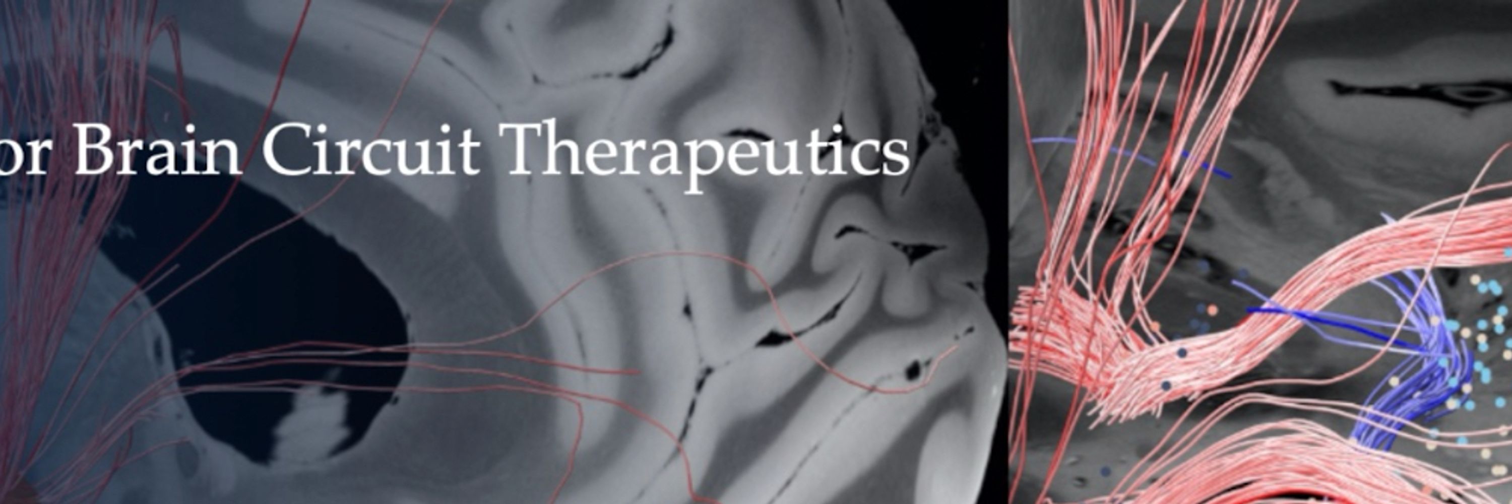 Center for Brain Circuit Therapeutics