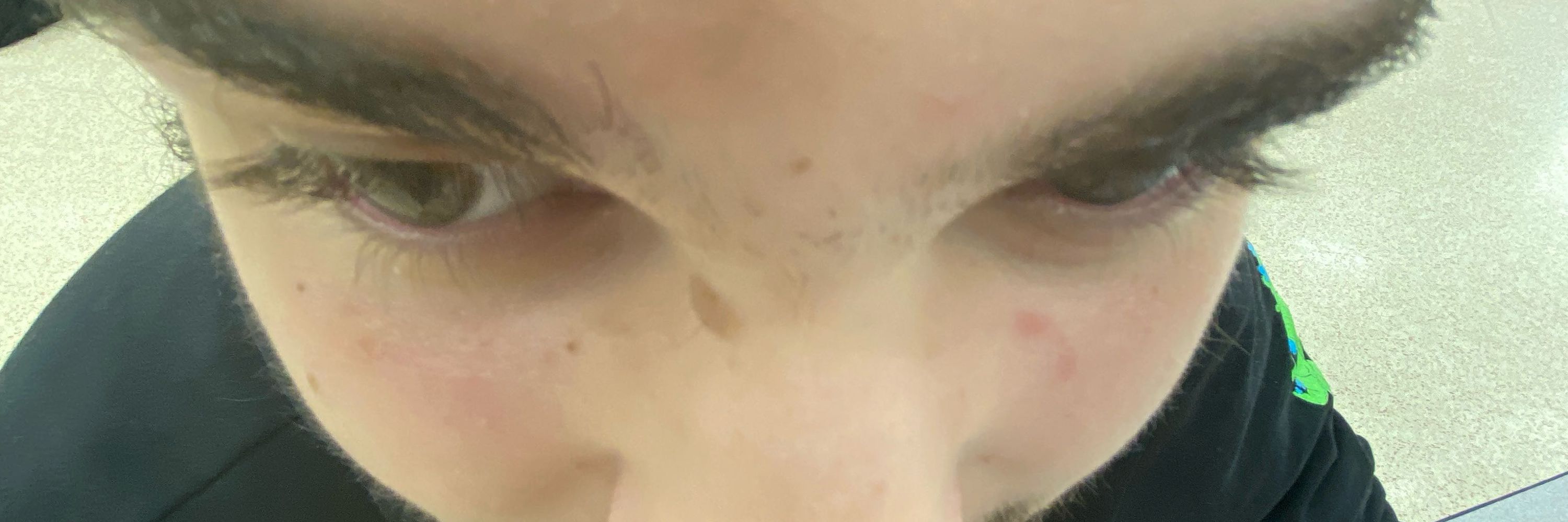 Lynalout