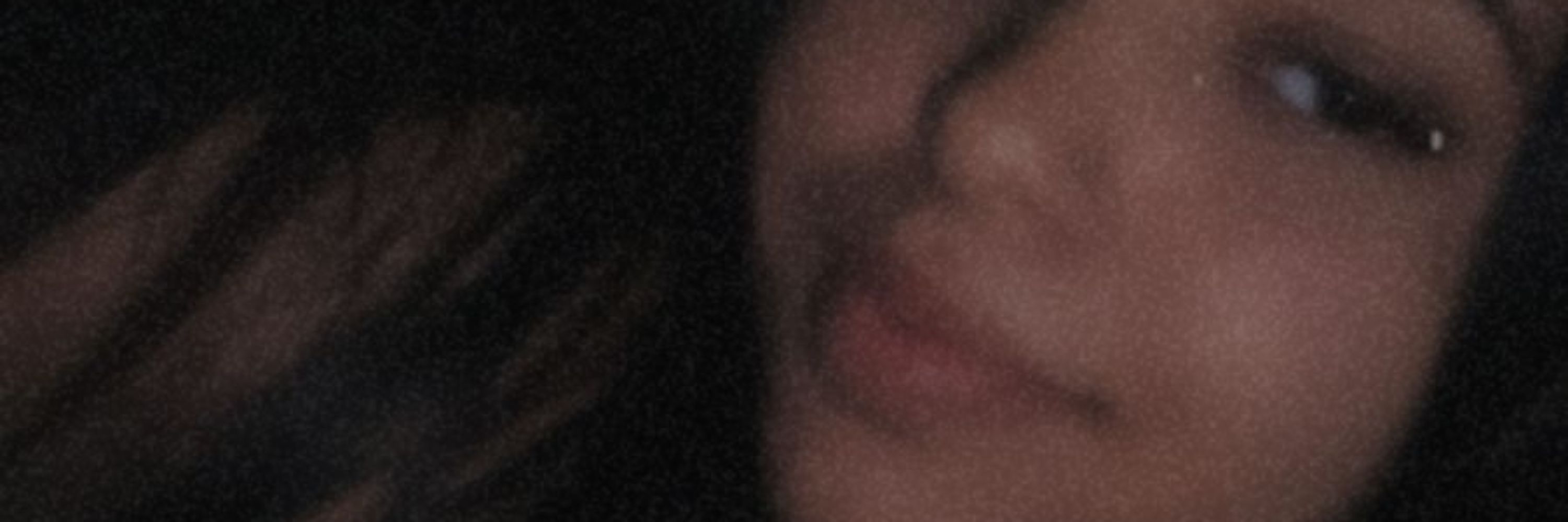C.💋
