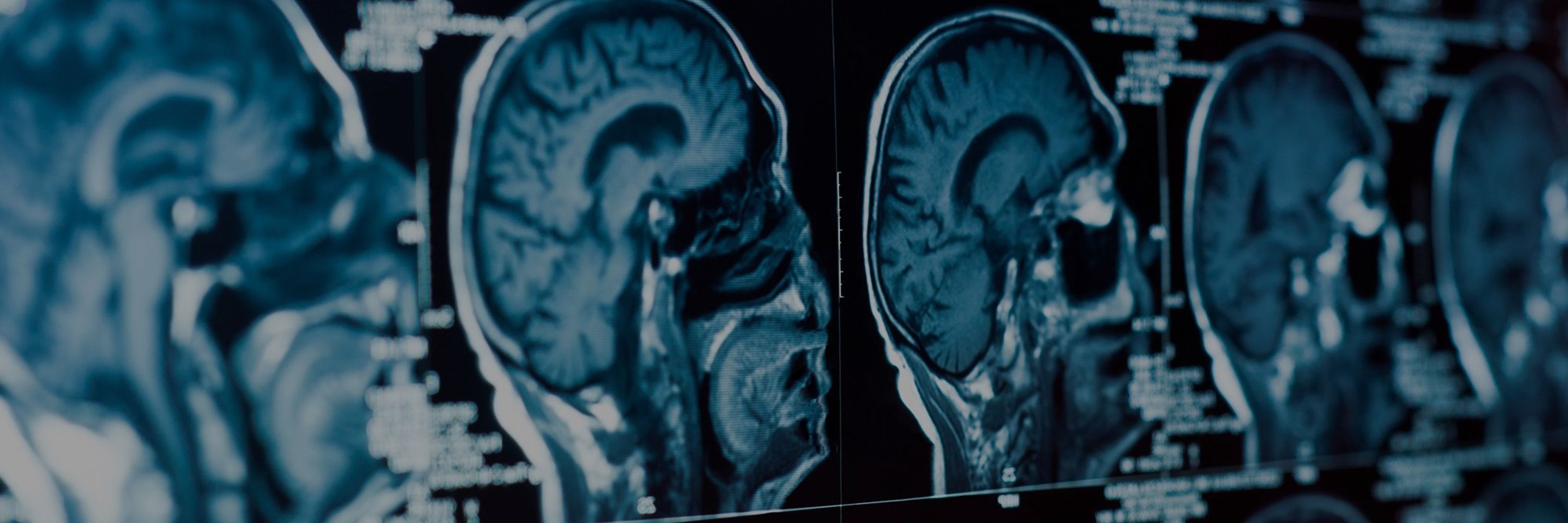 Canadian Centre for Behavioural Neuroscience