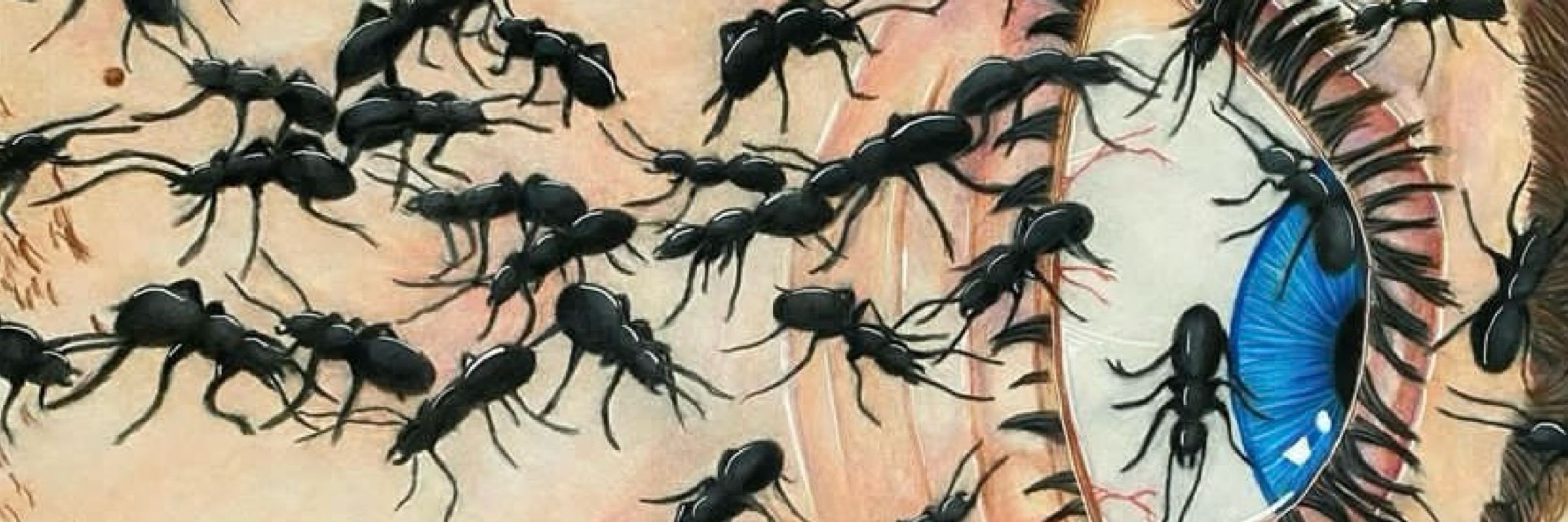 Twisted Toenails Poetry