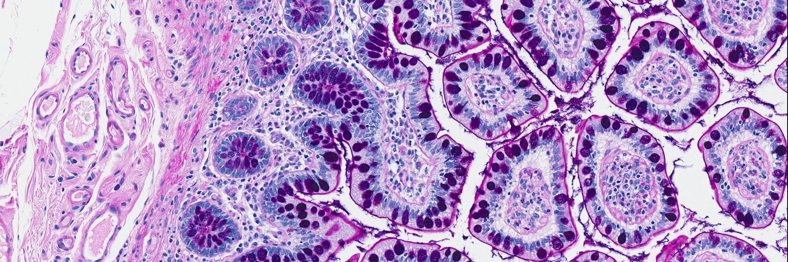 UNMC Pathology, Microbiology & Immunology