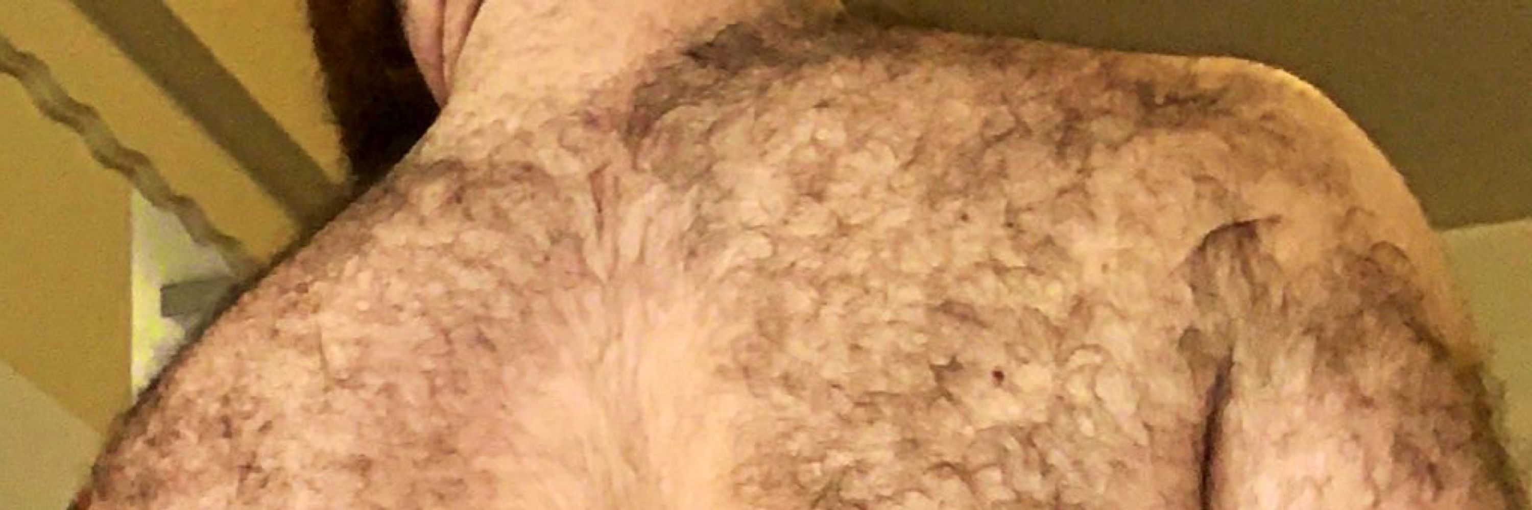 Furball