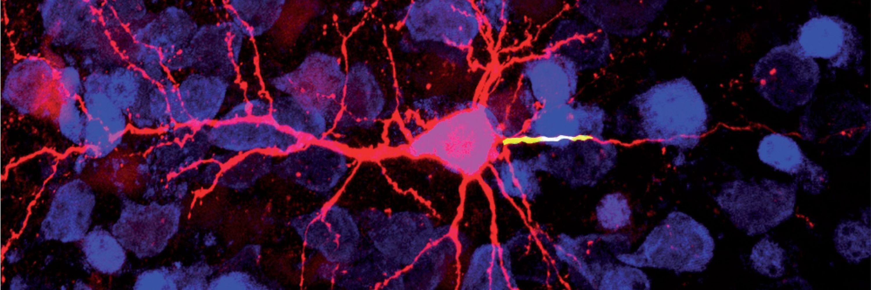 Mannheim Center for Translational Neuroscience