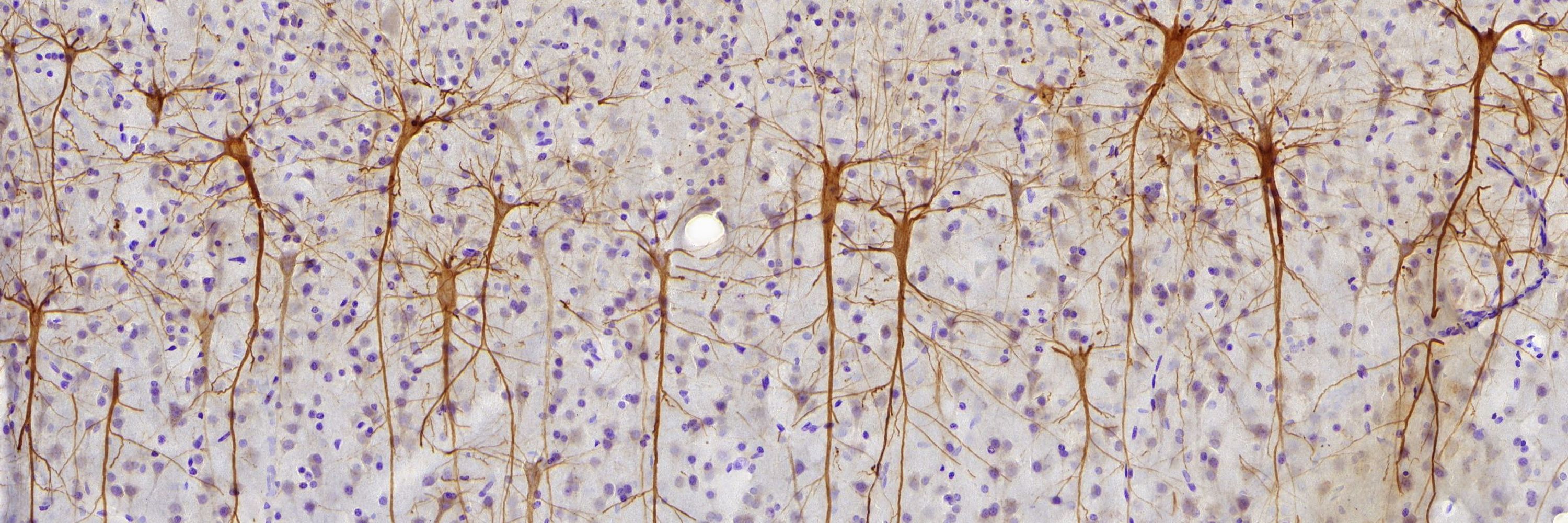 Institute of Neurodegenerative Diseases 