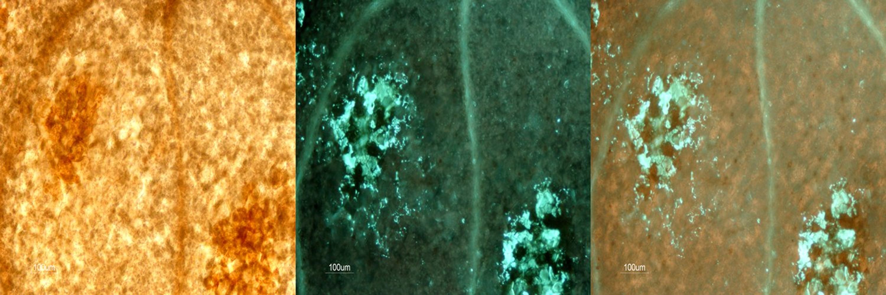Plant Immunity and Biochemistry