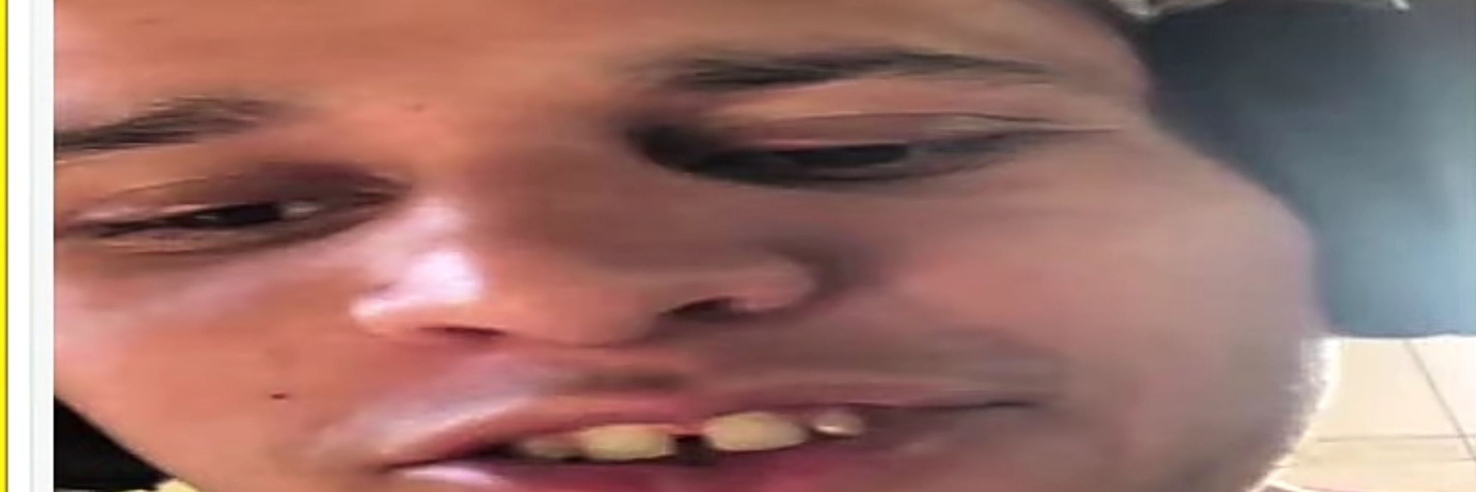 Lg7