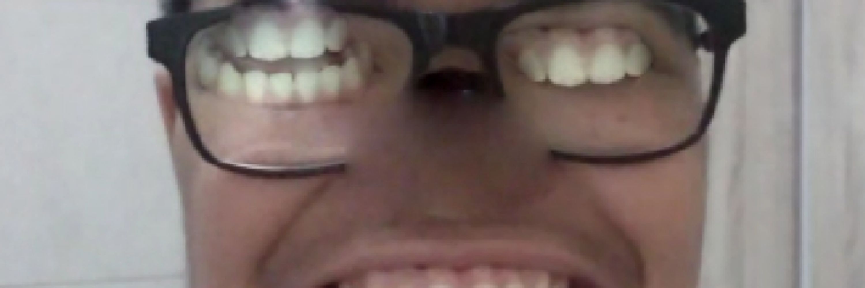 lus