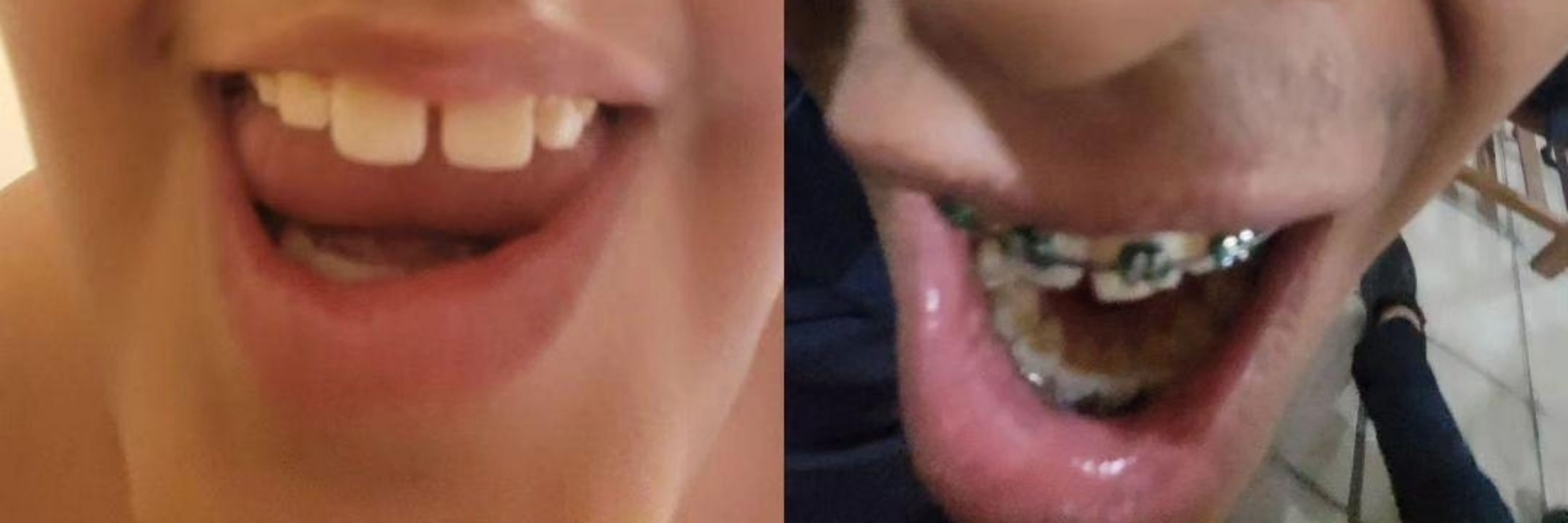 pedrocaa