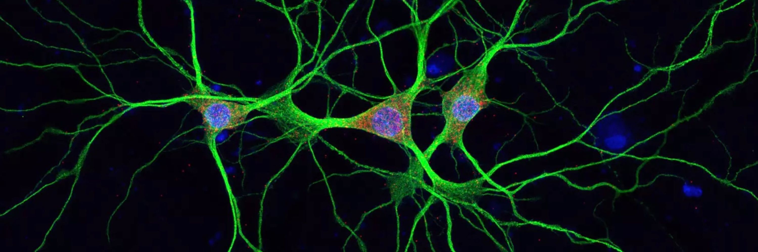 Max Planck Institute for Brain Research
