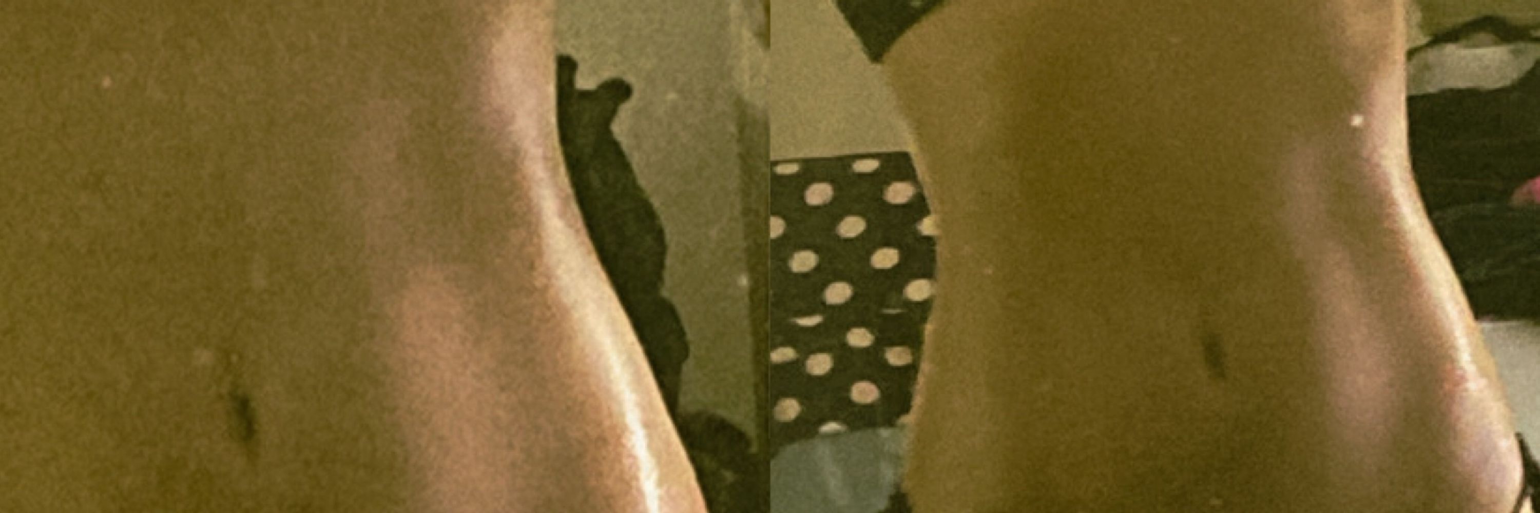 carol