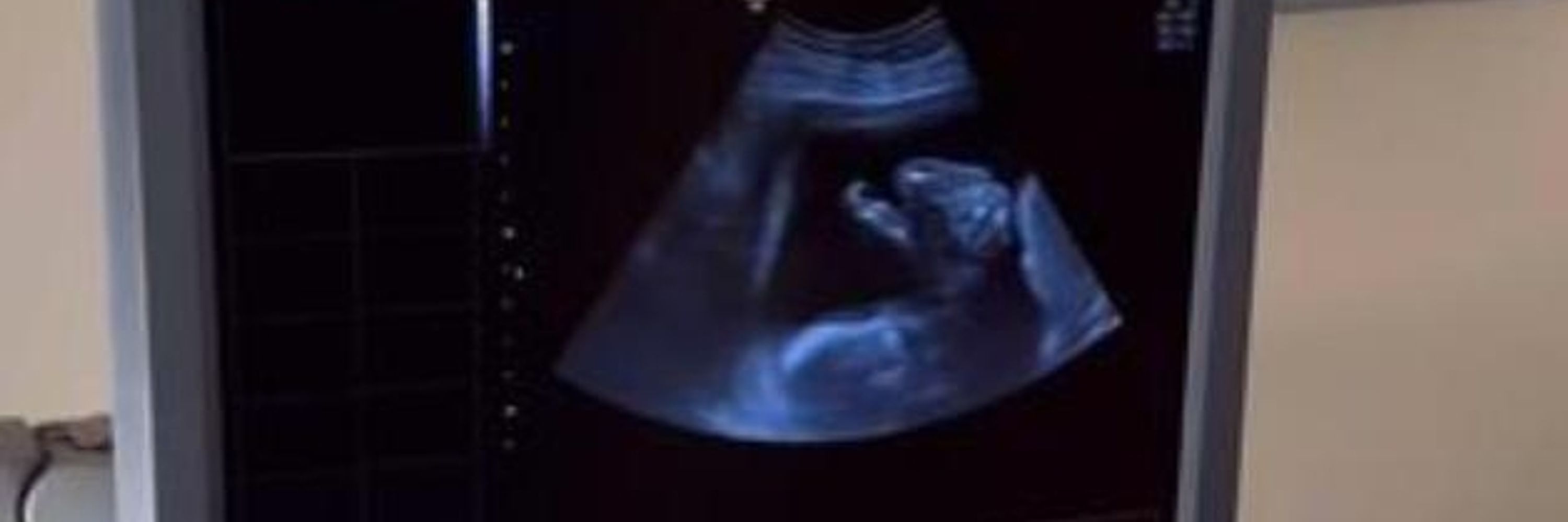 Help Adeel, her child and her unborn baby