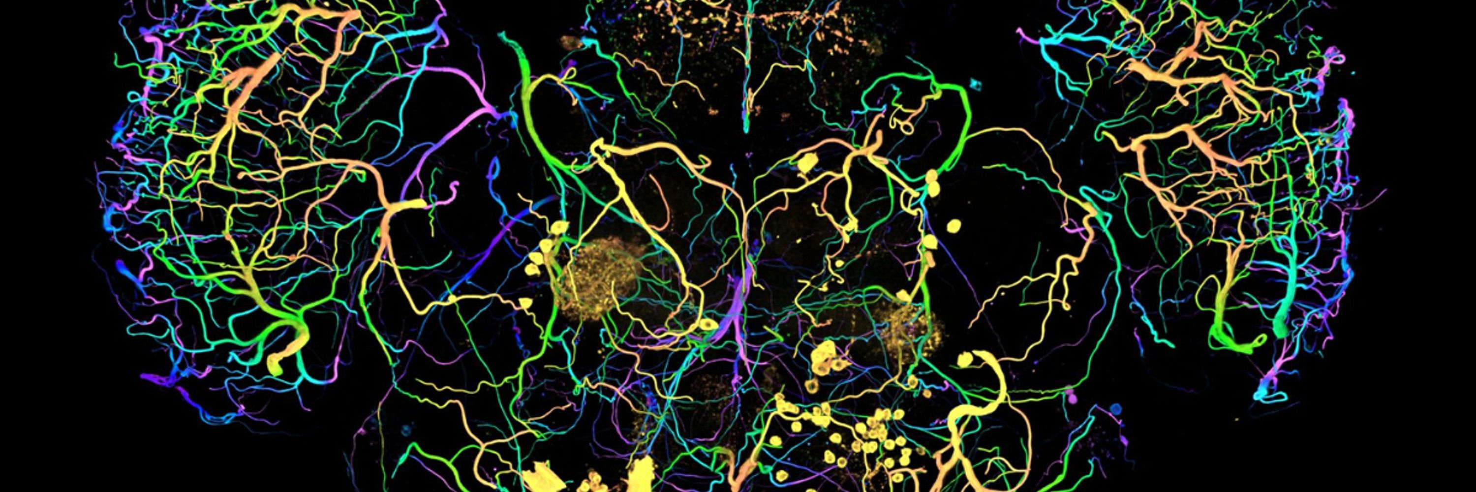 VIB-KU Leuven Center for Brain & Disease Research