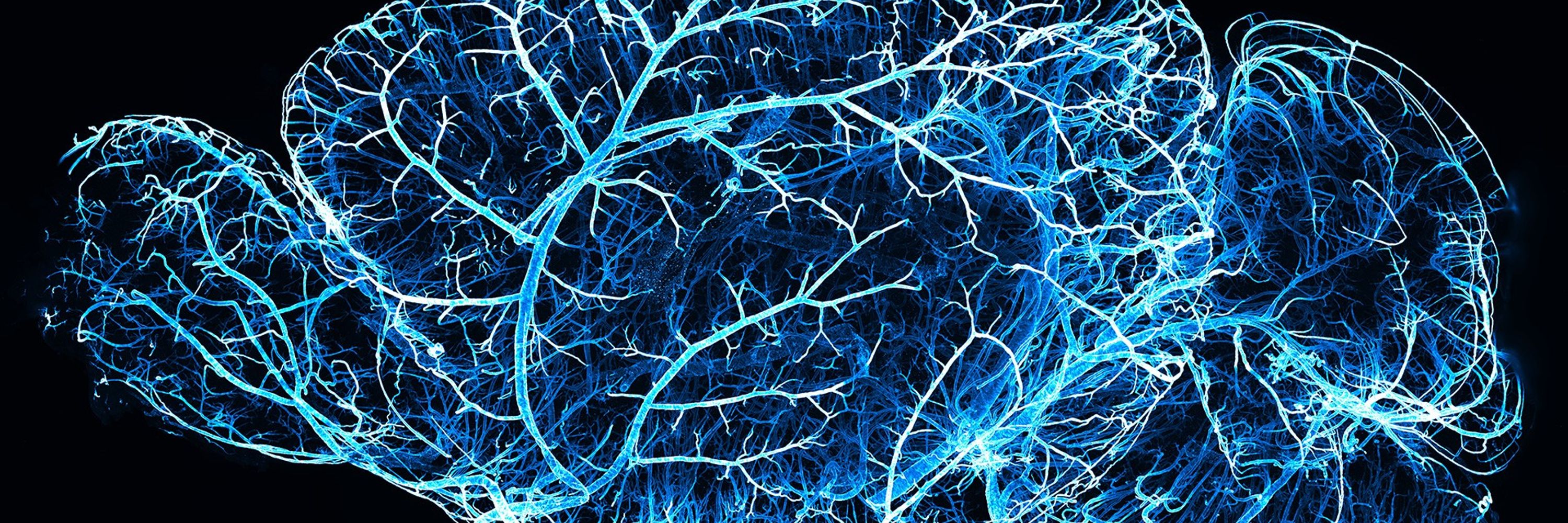 Translucence Biosystems