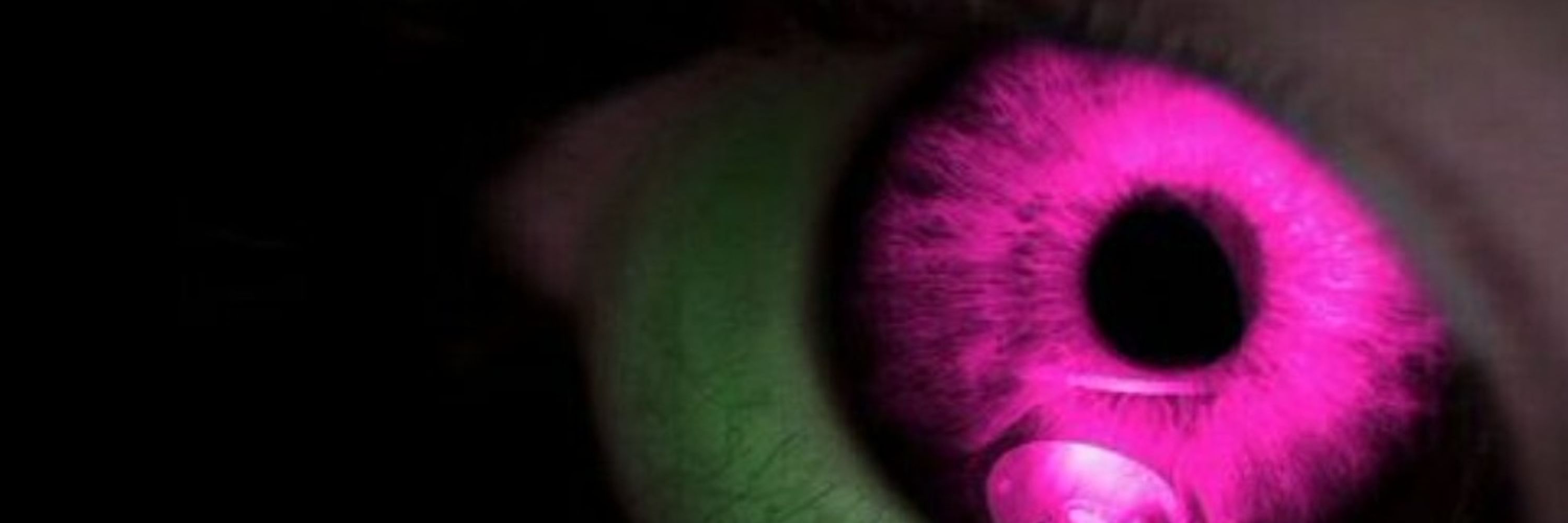 Dazzle Eyes