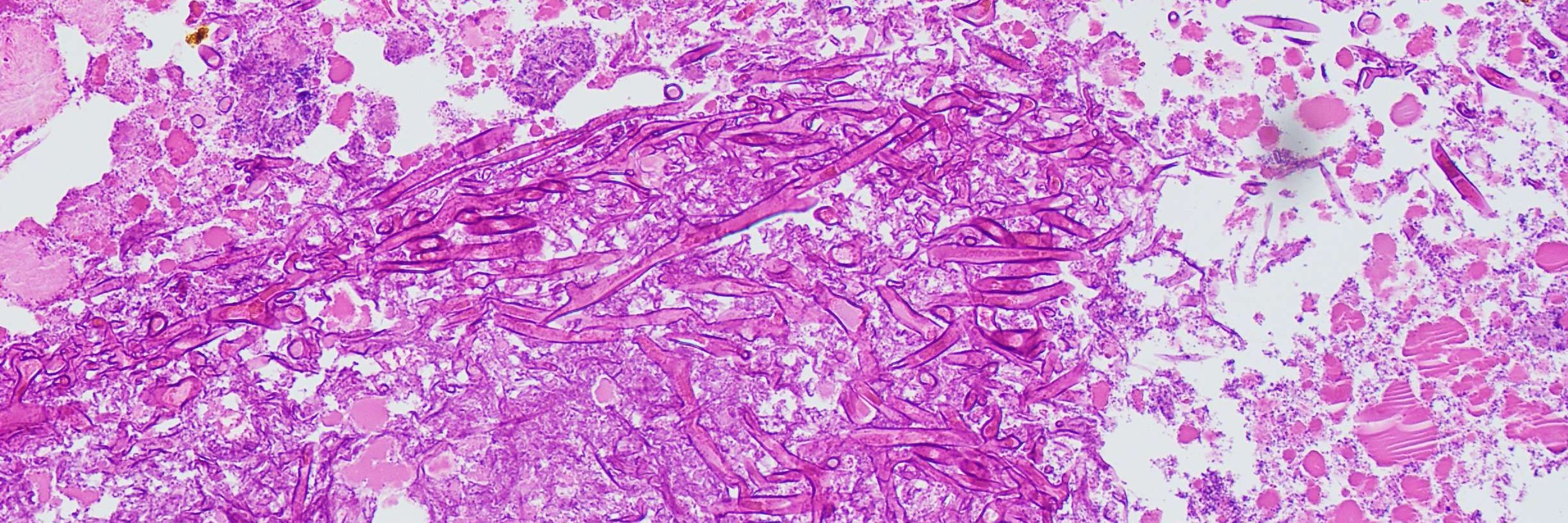 Nicholas Moore, PhD, D(ABMM)