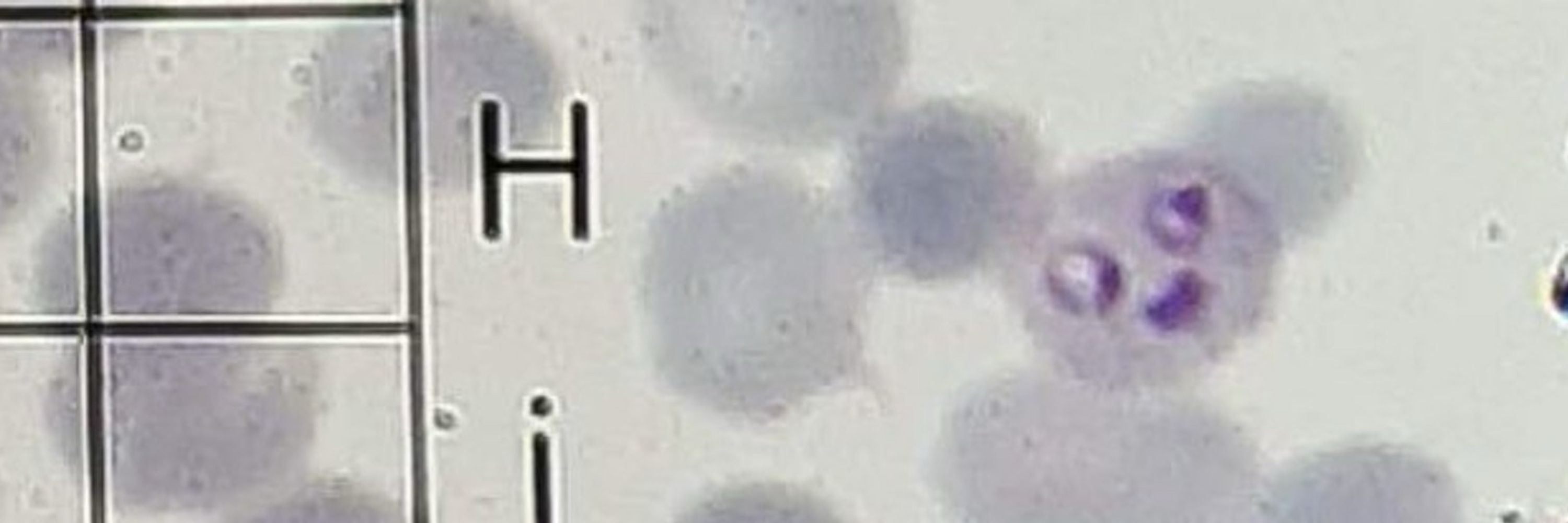 Nanomalaria