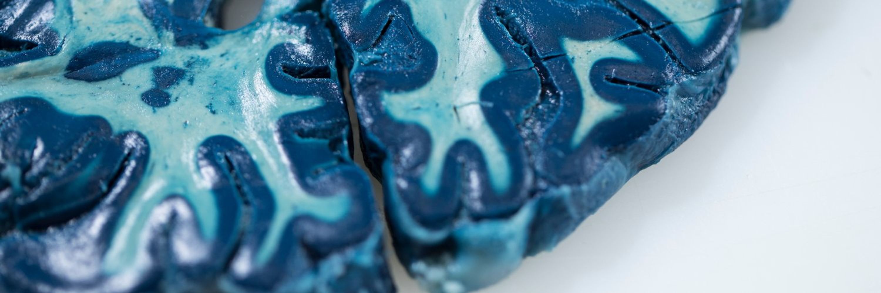 Department of Brain Sciences
