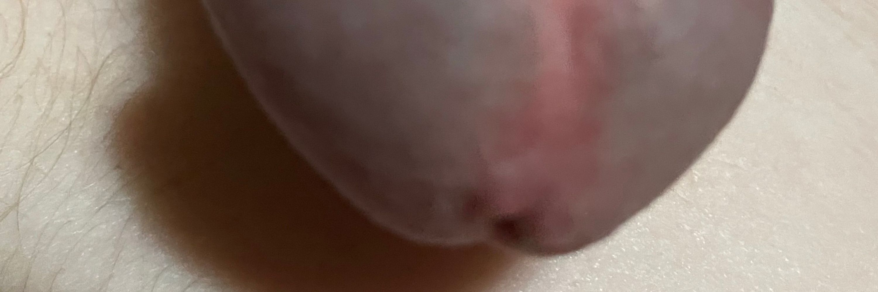 Bugs