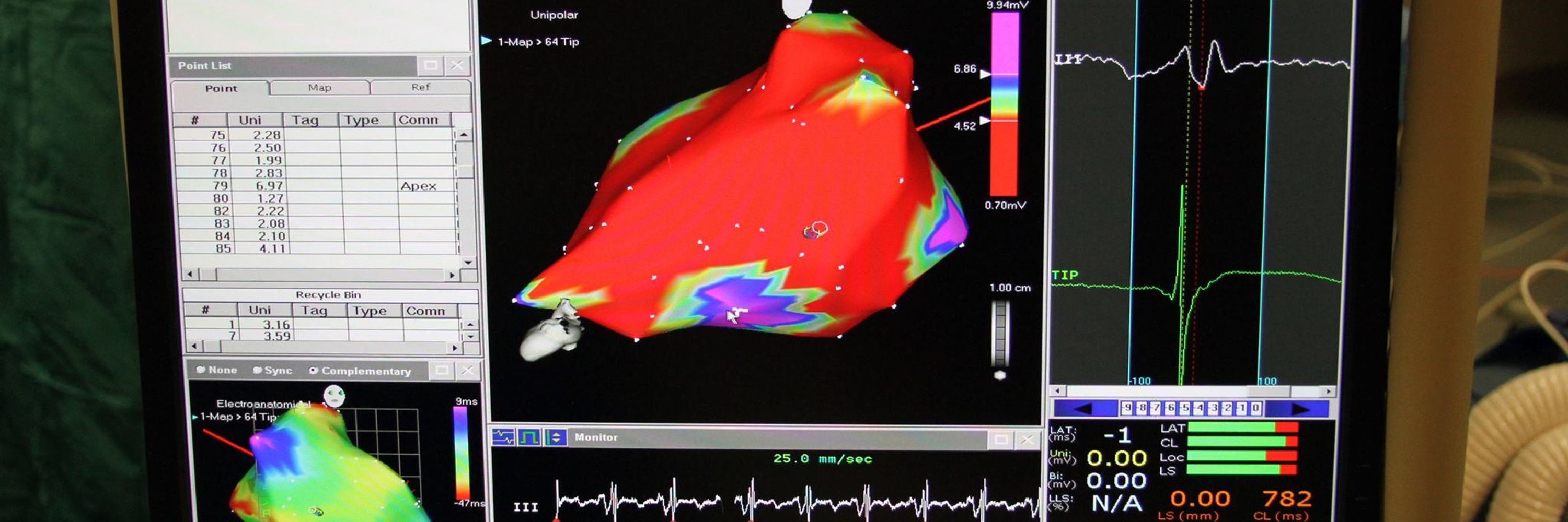 Emory Cardiology
