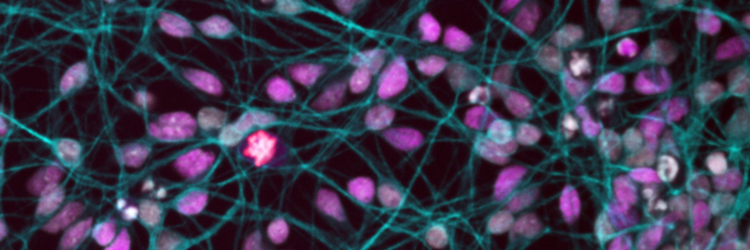 Rare Disease and Neurodevelopmental Disorders Lab
