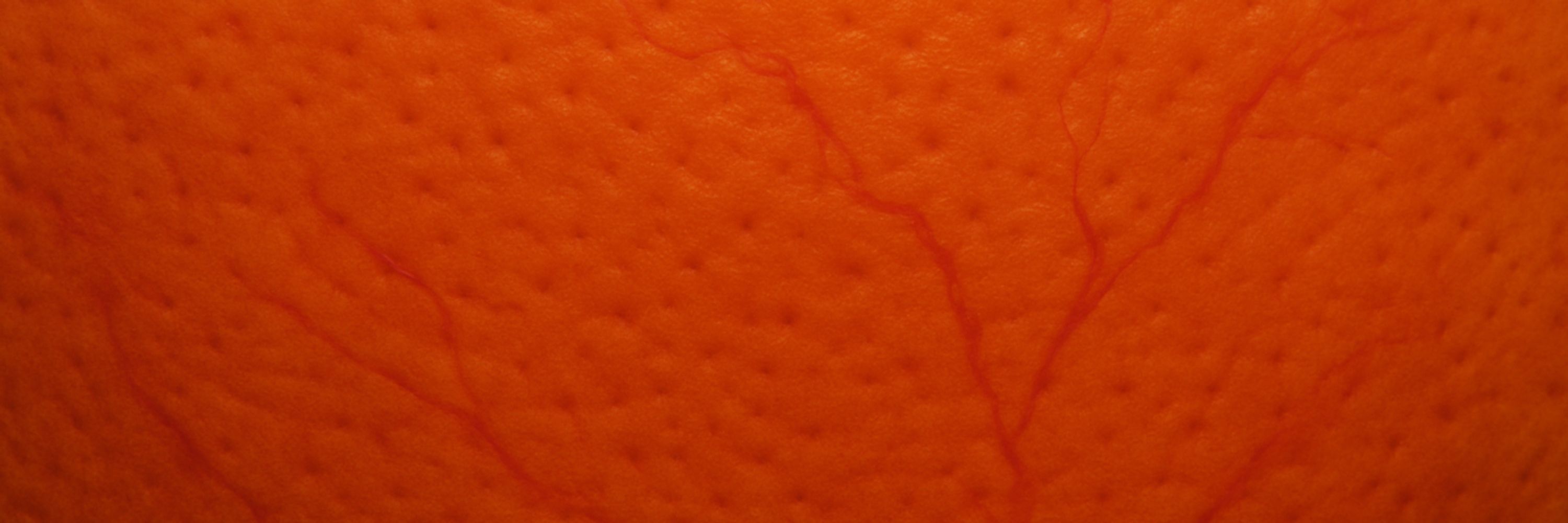 Bulbous Orange Tick