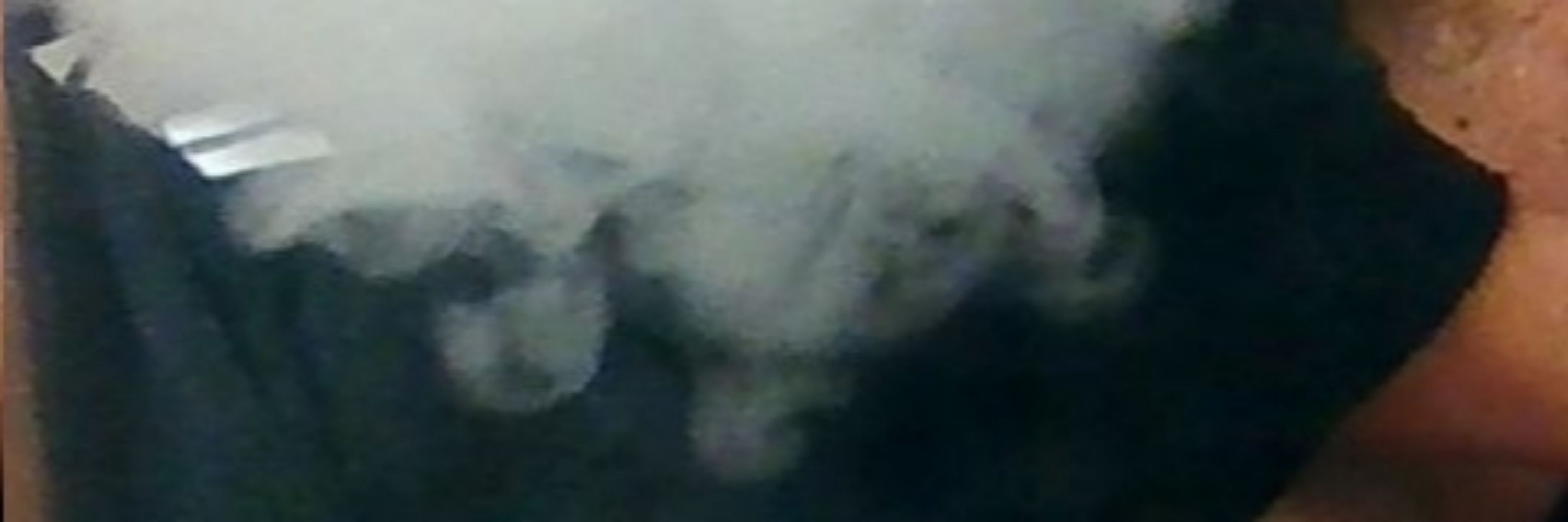Cloudy Vers YYZ