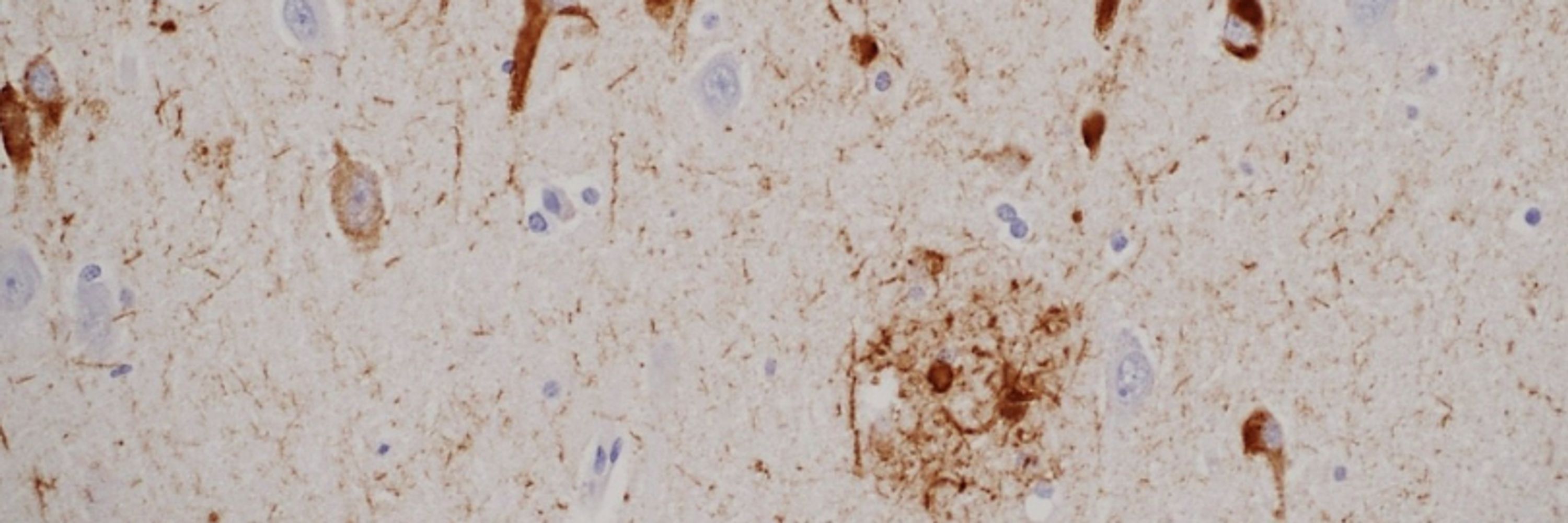 Jamie Walker, MD, PhD