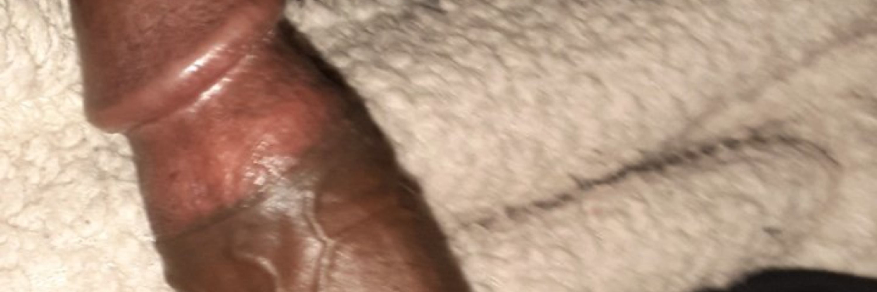 Htxbbc
