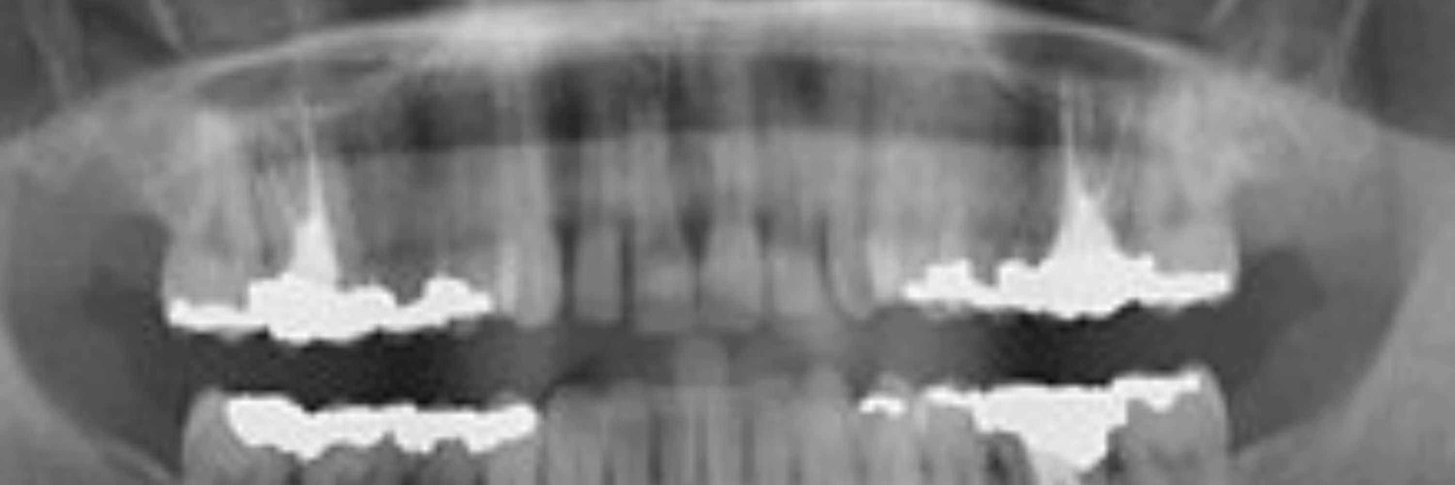 Periodic Reminder to Unclench Your Jaw