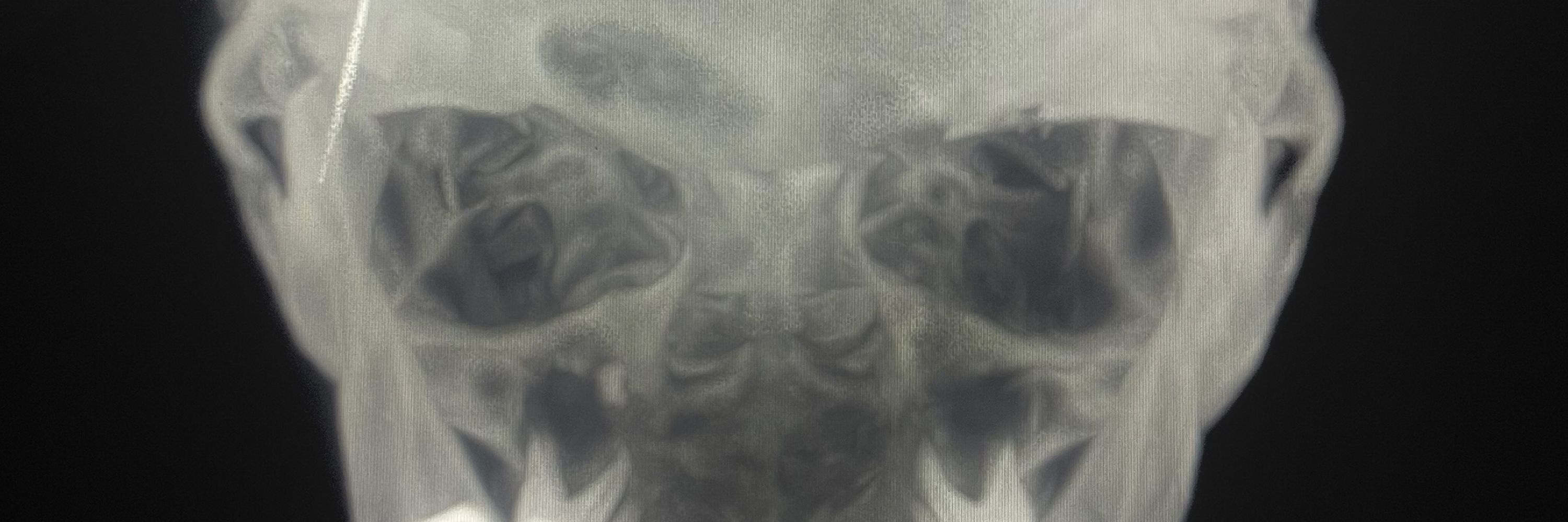 neuroniumx
