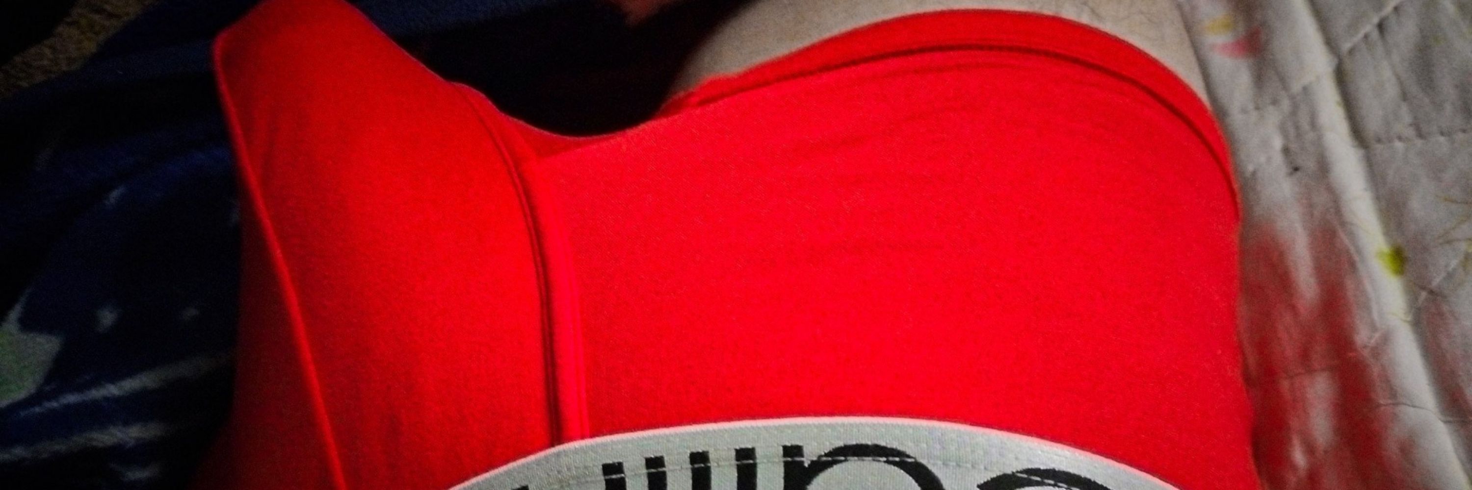 Fluke.