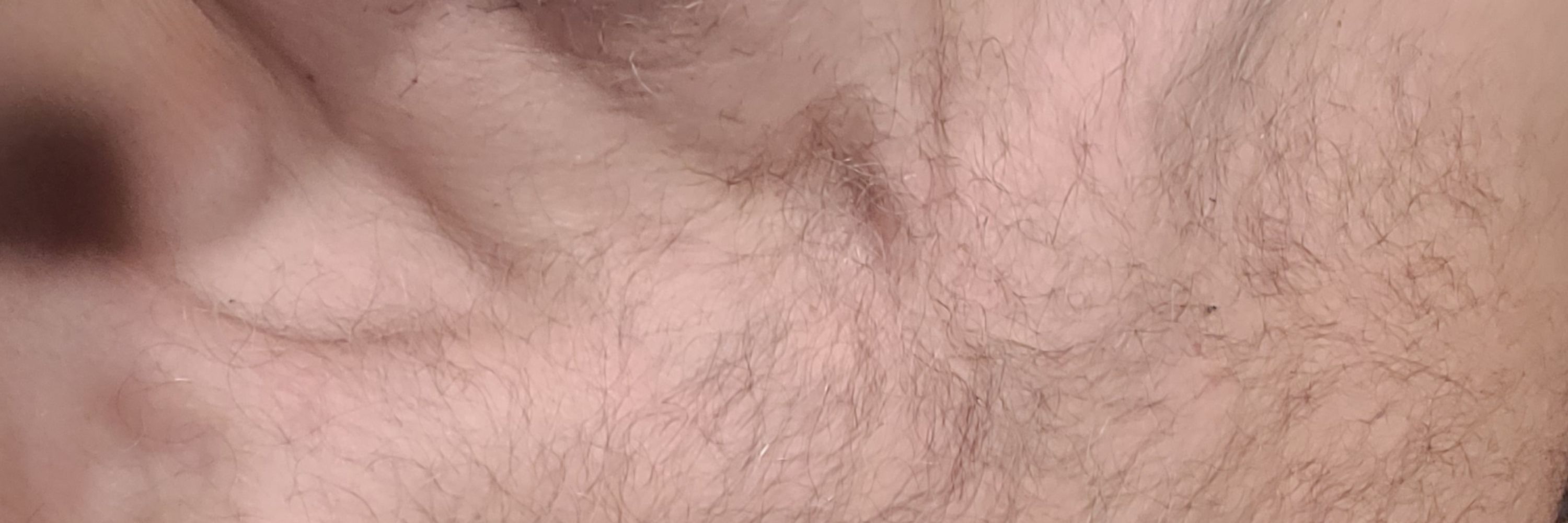 Monkeyface, or something
