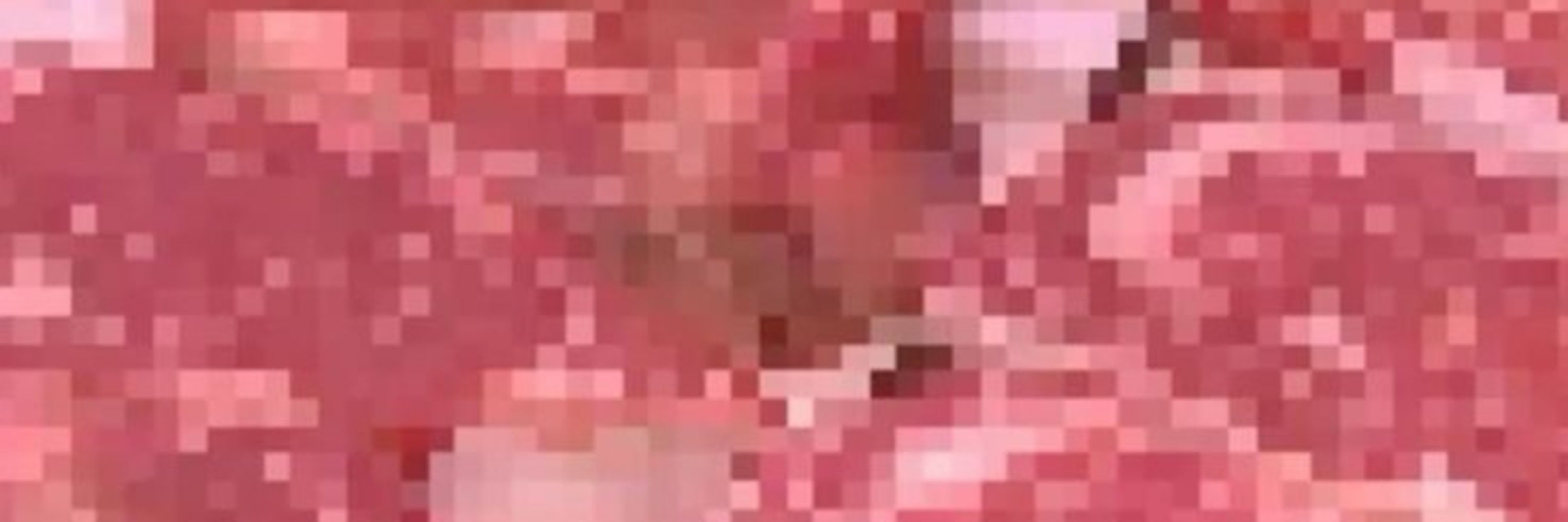 Teku