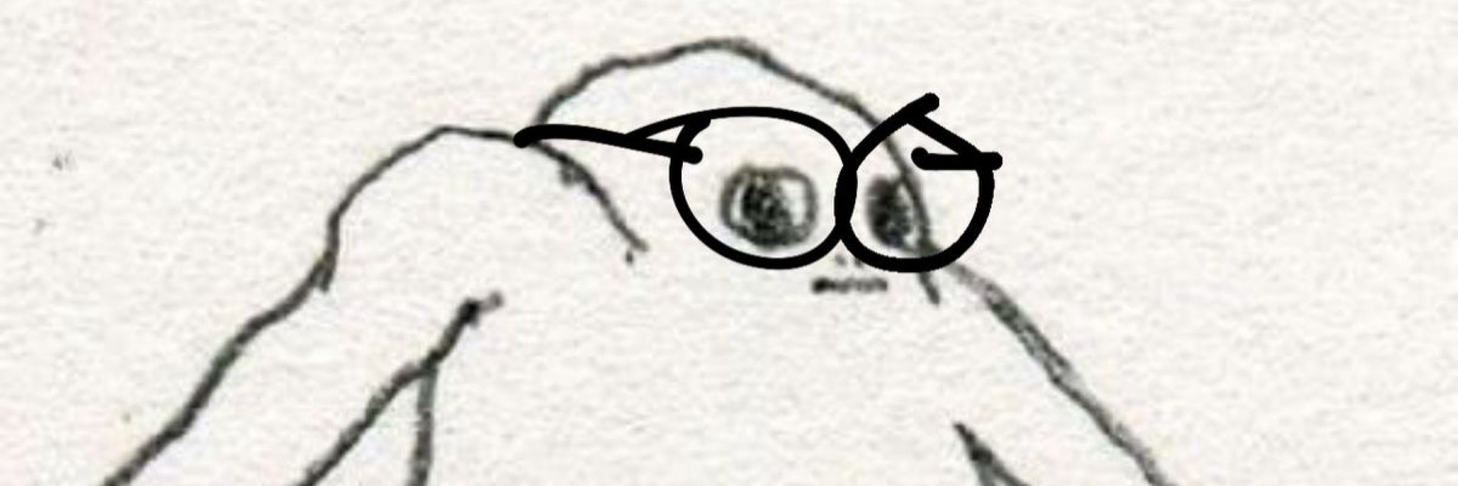 bespectacled hater, MS