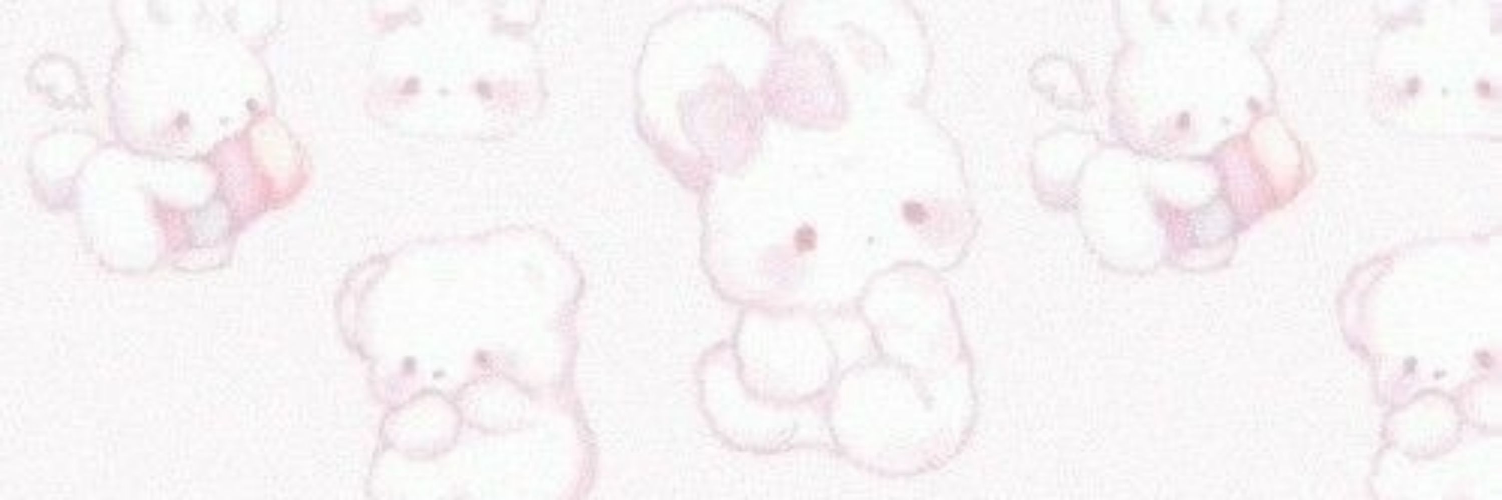 あほ
