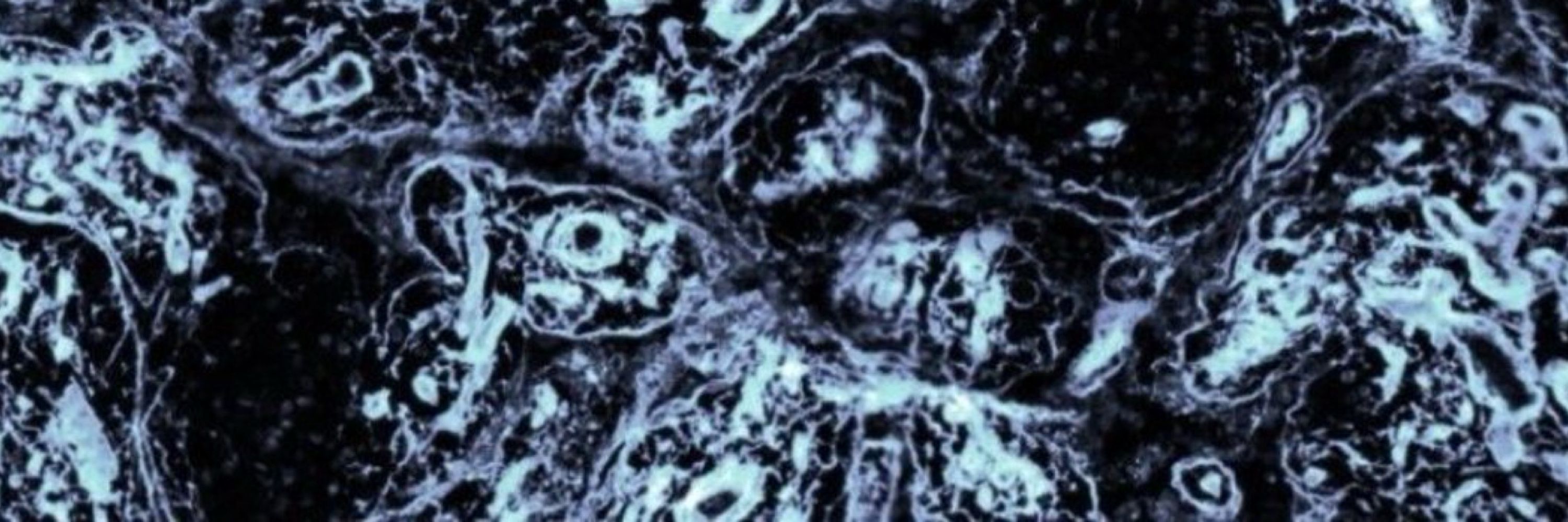 three T cells in a trench coat