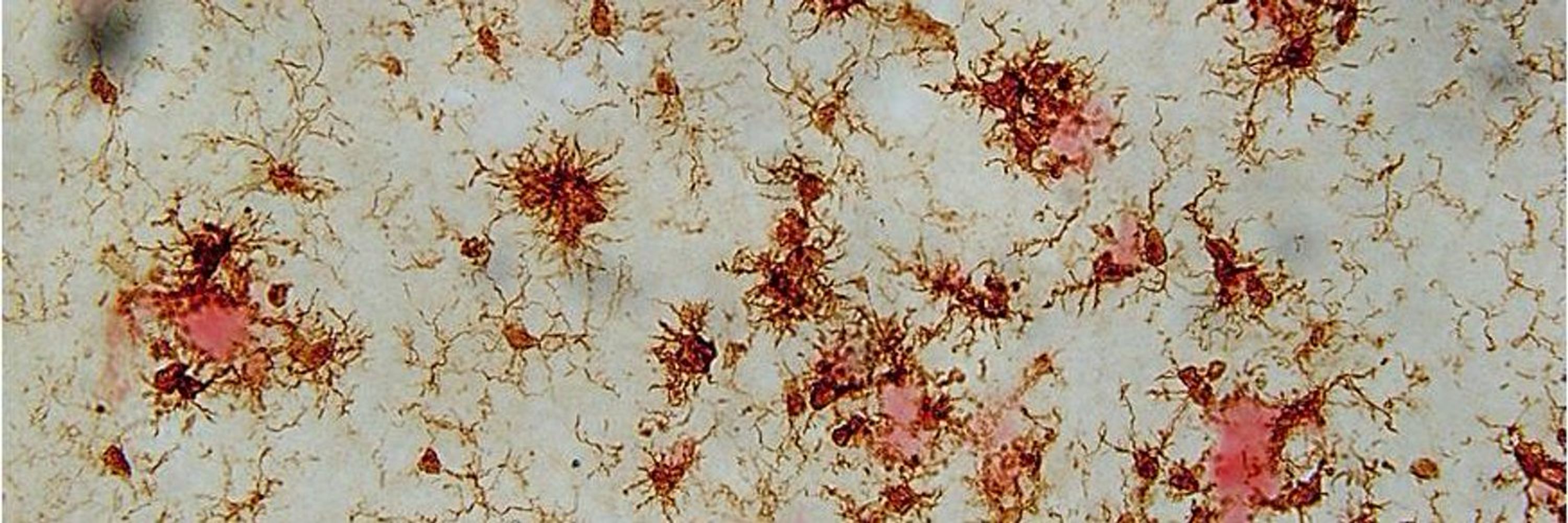 TrinityNeuroscience