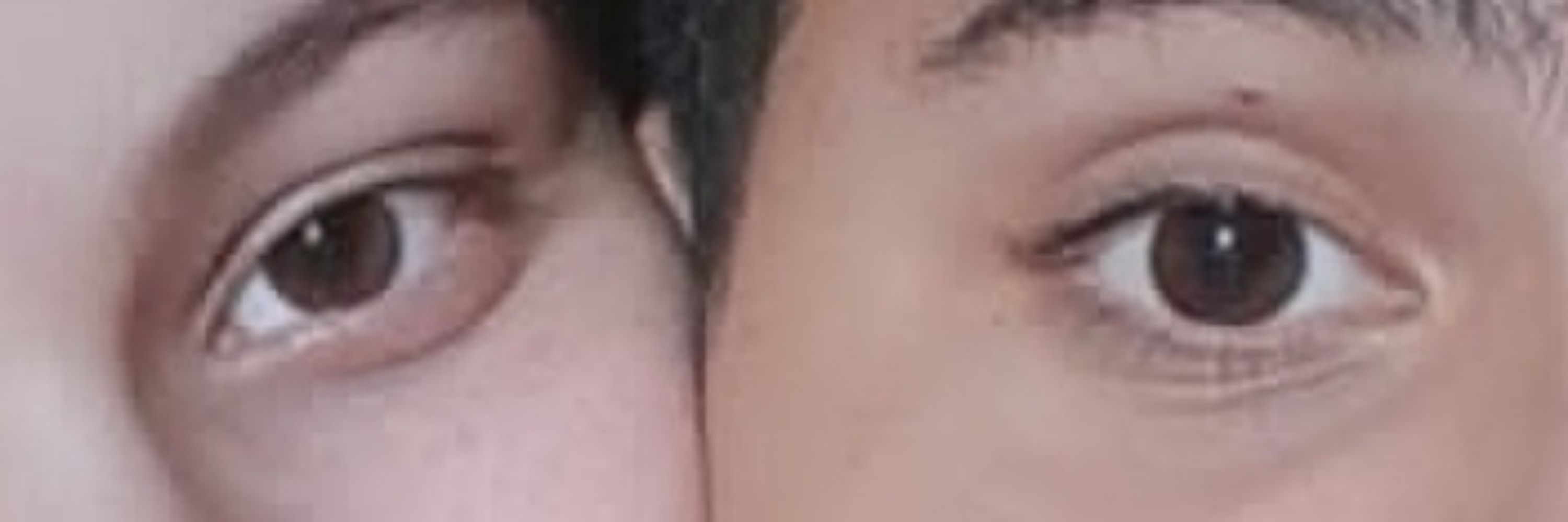 anavi