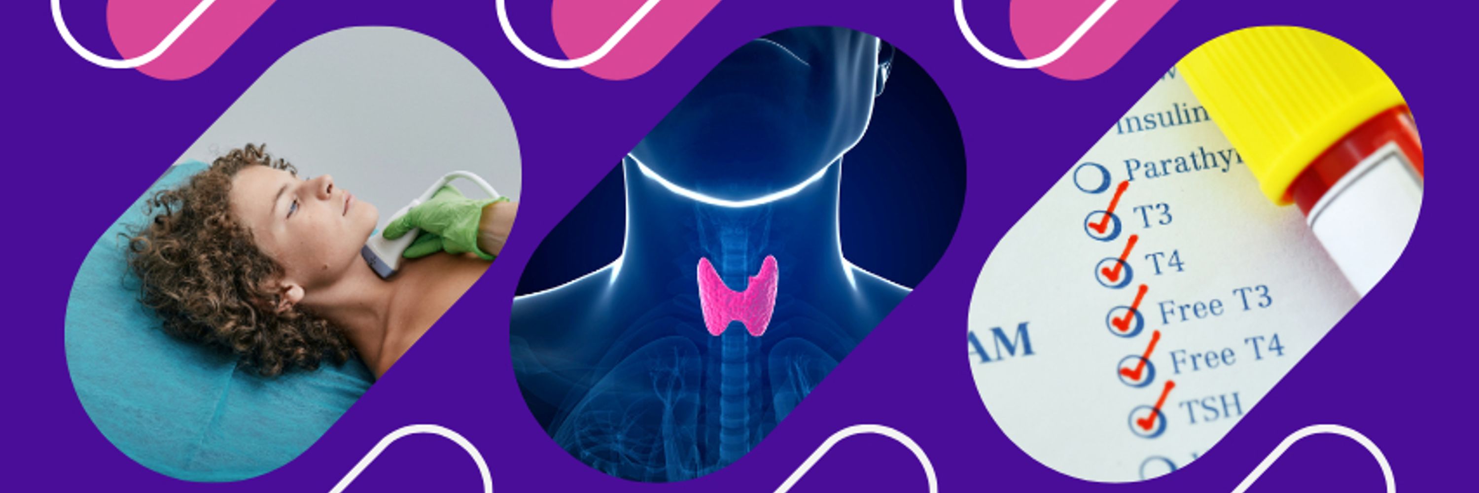 Thyroid UK