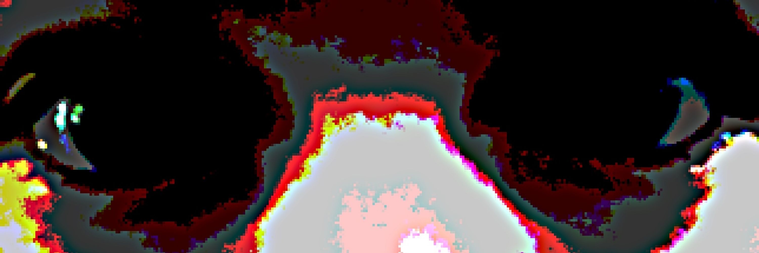 Pain