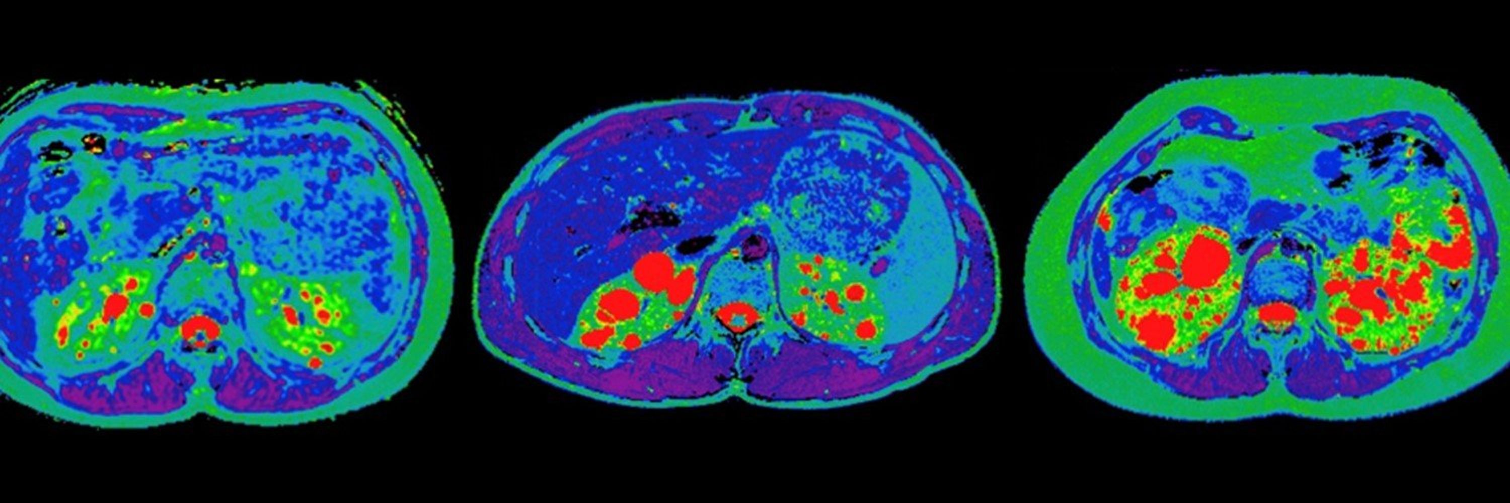 Kidney International