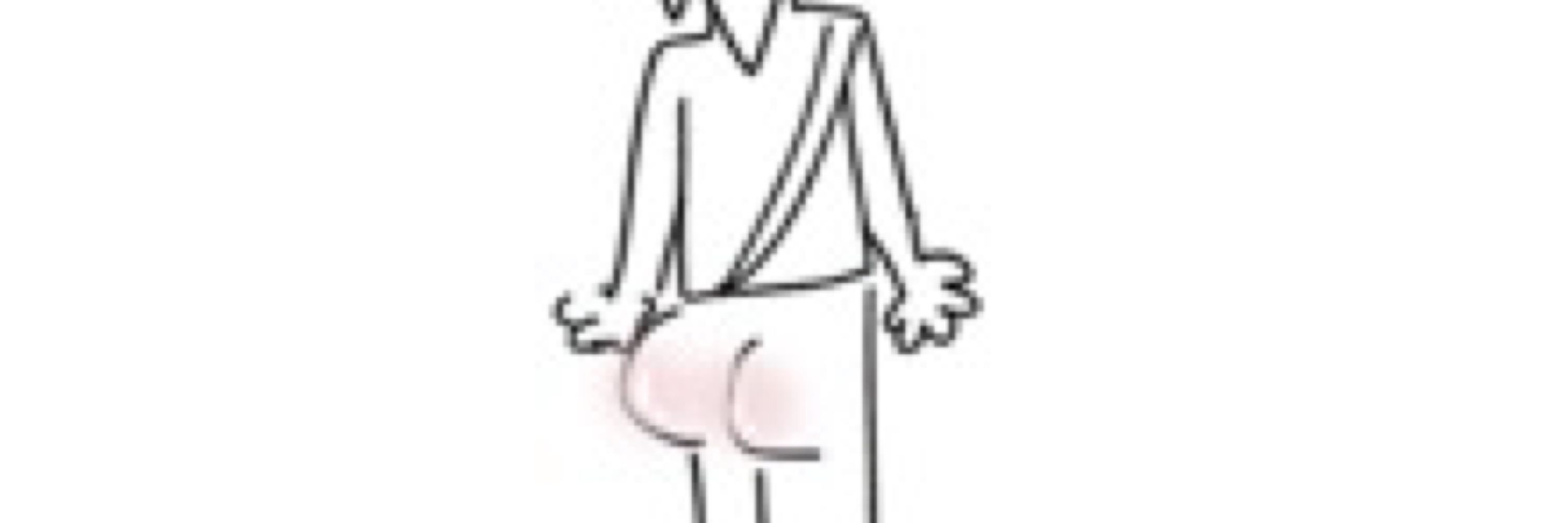 アサシン