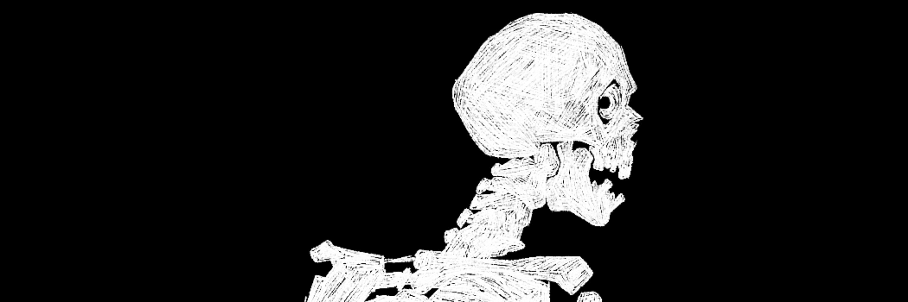 ☠️﹐᥉ჩᥲᥰkყᦸ﹗
