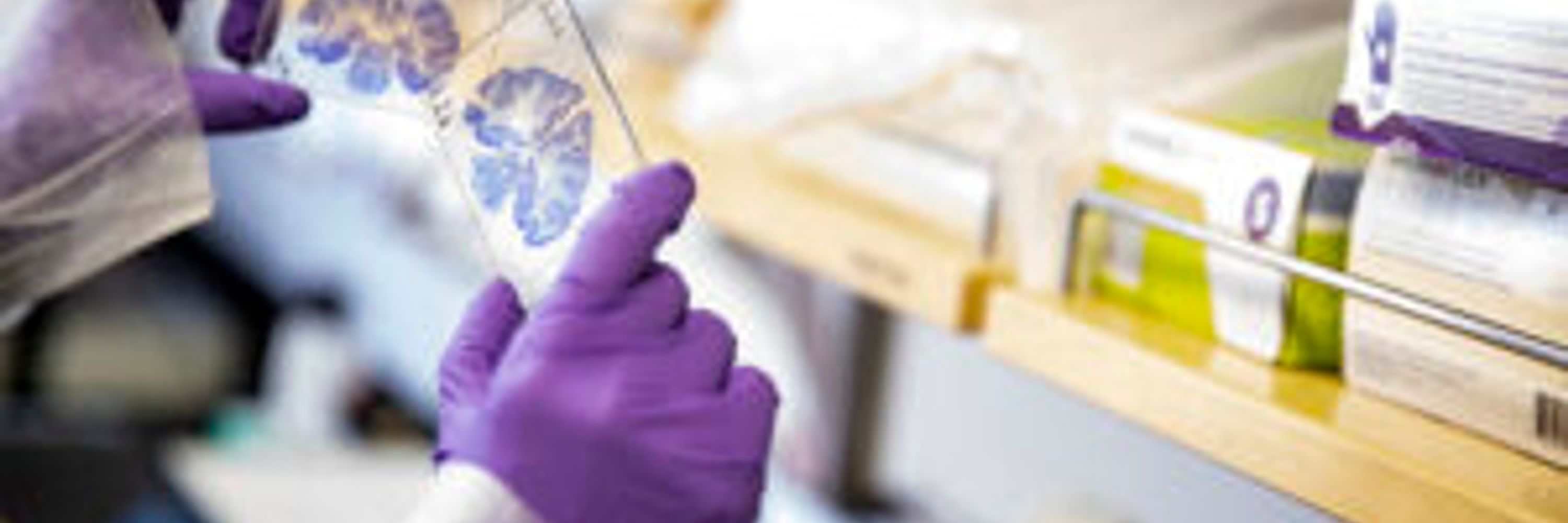 UW Bioengineering