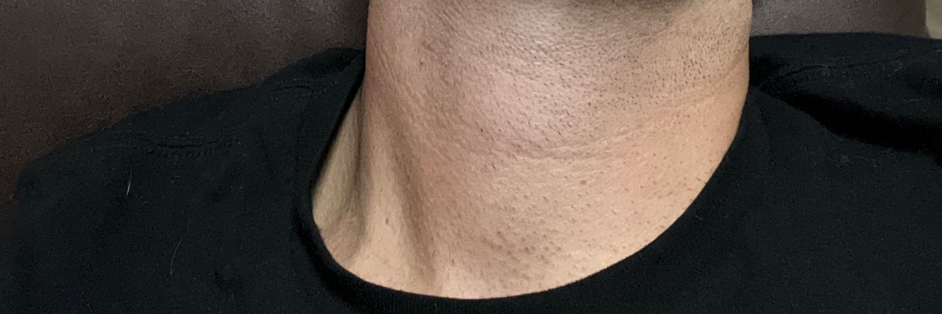 dc throat