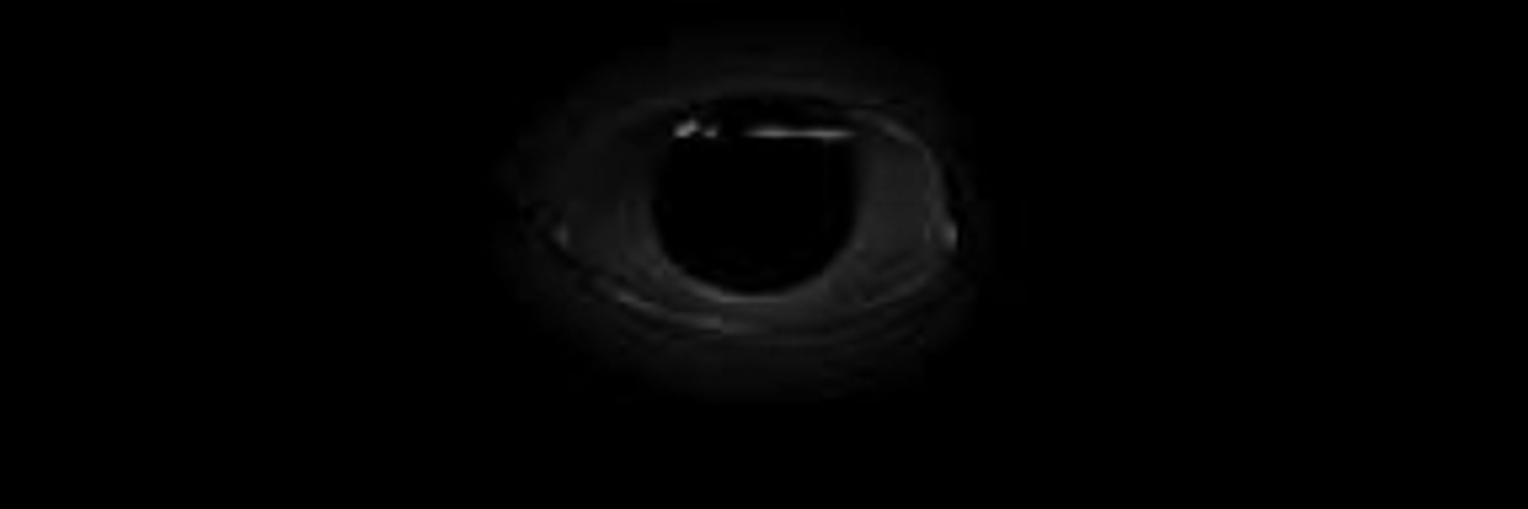 THE WATCHER
