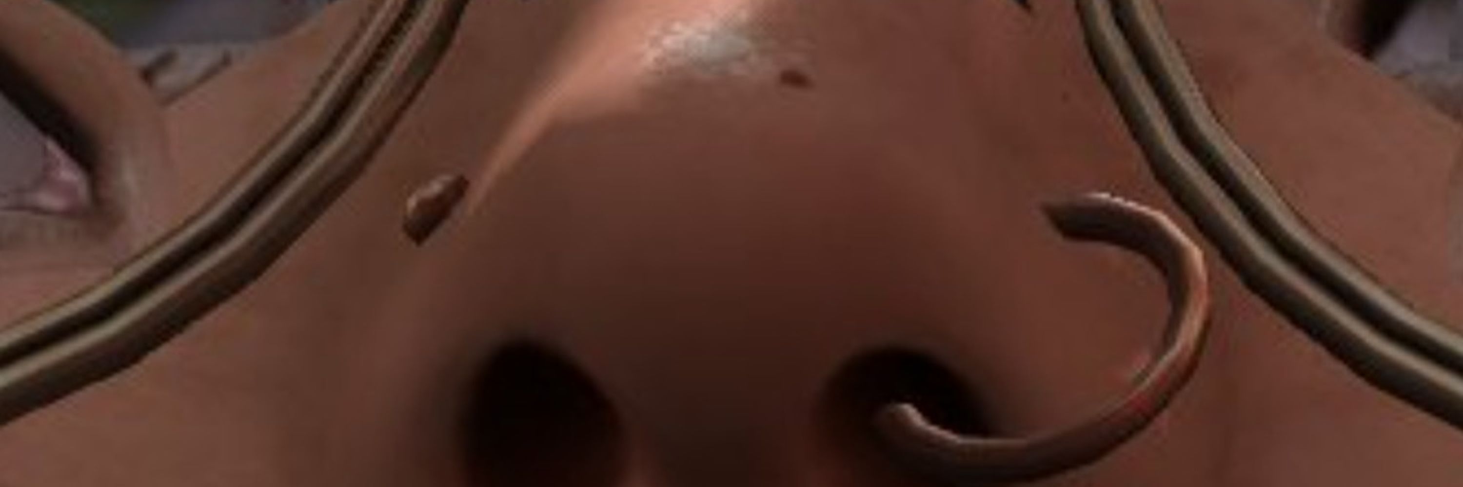 Eyelash Bug