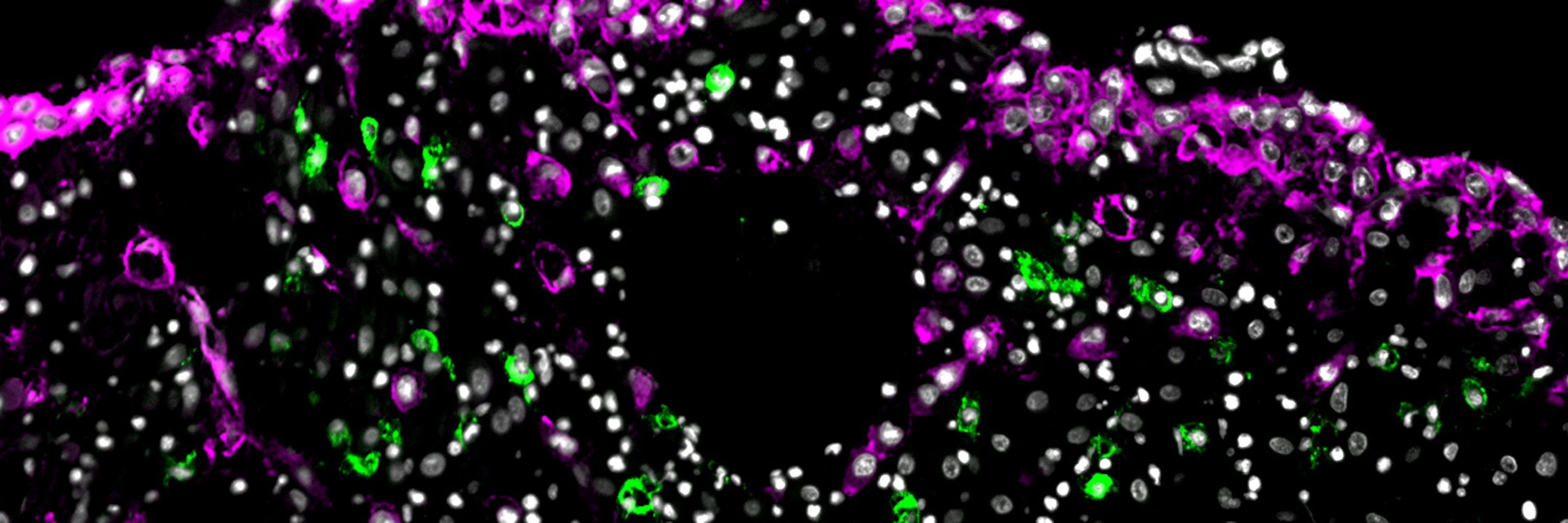 Maternal-Fetal Immunology Group (MFIG)