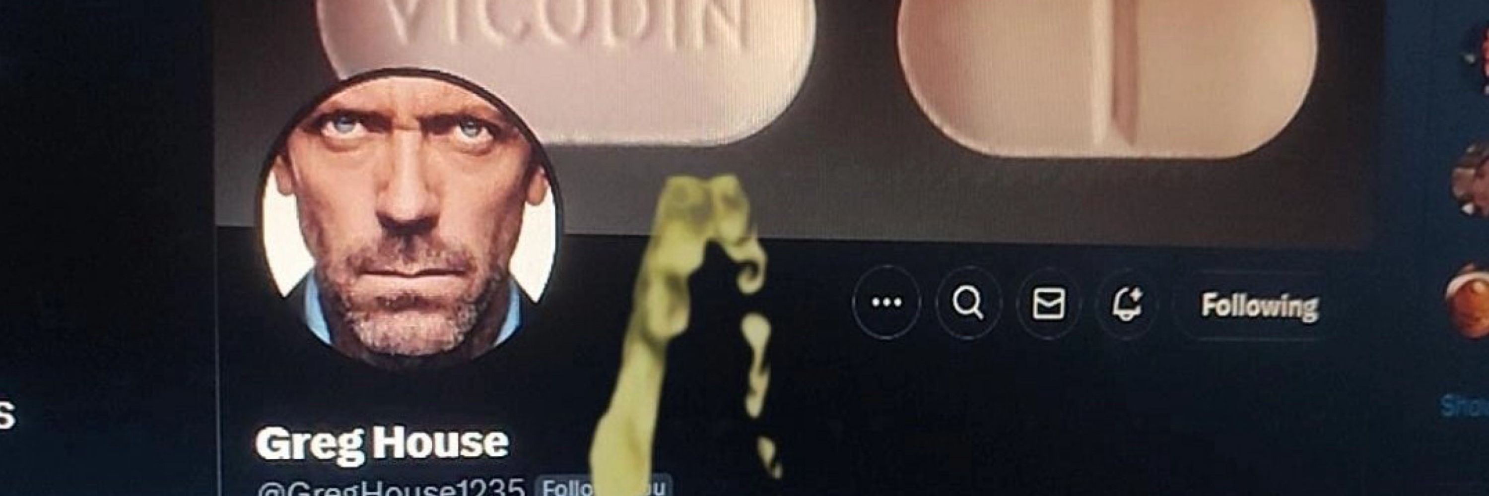 Bones